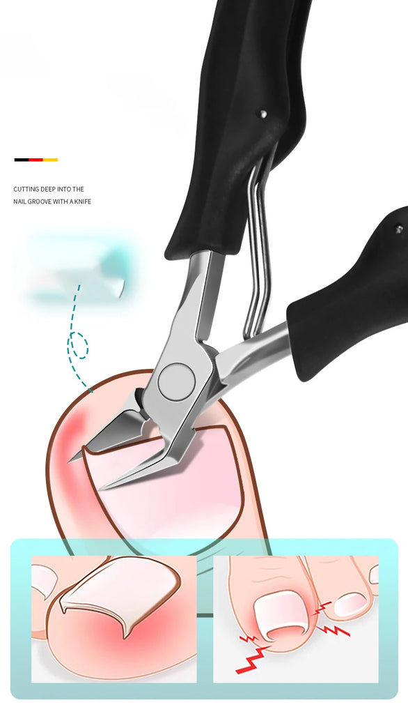 Professional Sharp Toenail & Cuticle Nipper – Precision Ingrown Nail Clipper & Dead Skin Remover